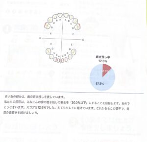 2歳10ヶ月 予防歯科　歯科検診