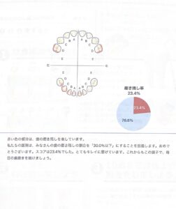 2歳10ヶ月　歯科検診　予防歯科
